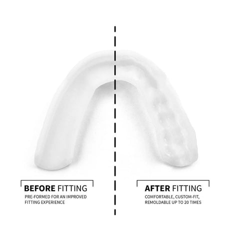 sova 3d oral care night guard with case