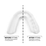 sova 3d oral care night guard with case
